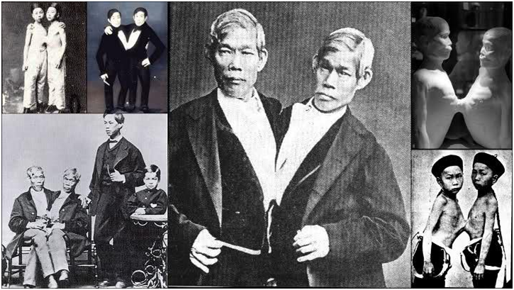 Чанг и Энг Банкеры: «Сиамские близнецы»